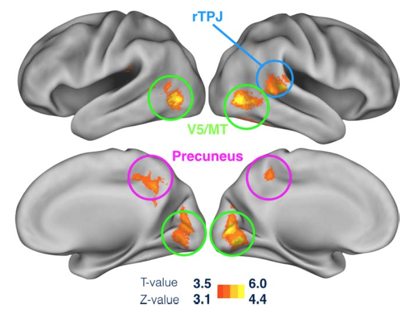 A novel measure to determine viewing priority and its neural correlates in the human brain